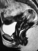irm genito urinaire pancrea